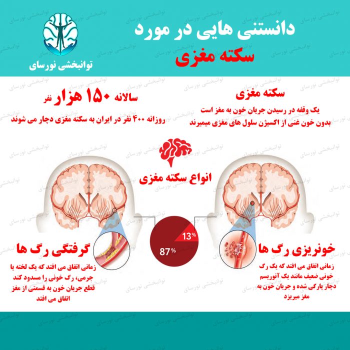 سکته مغزی چیست؟ علائم، علت، تشخیص و درمان آن سکته مغزی چیست؟ علائم، علت، تشخیص و درمان آن