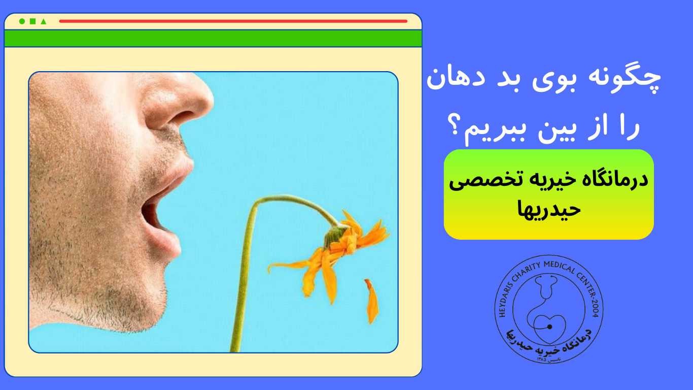 بوی بد دهان