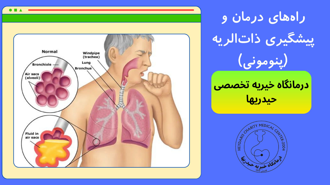 ذات‌الریه