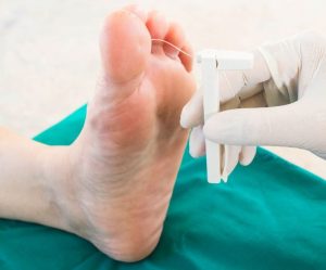 علل بیماری نوروپاتی دیابتی