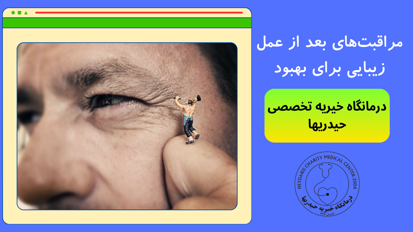 مراقبت‌های بعد از عمل زیبایی