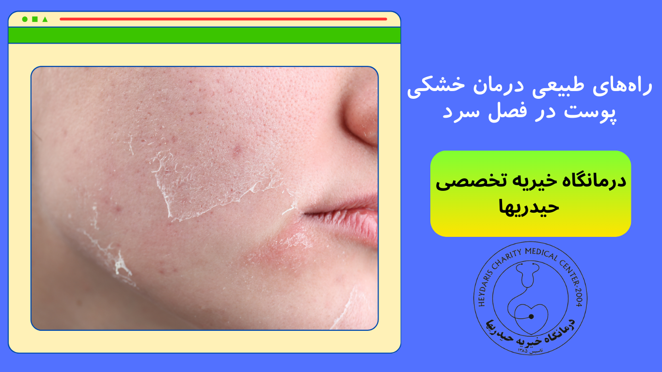 درمان خشکی پوست