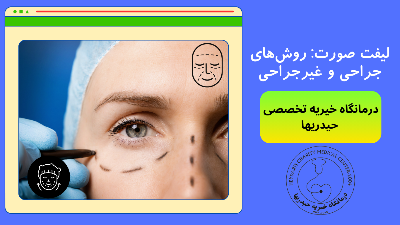 لیفت صورت