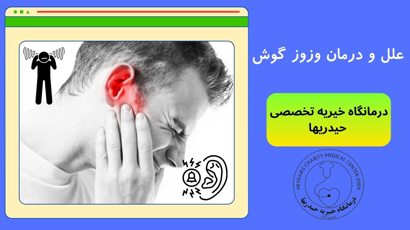 وزوز گوش
