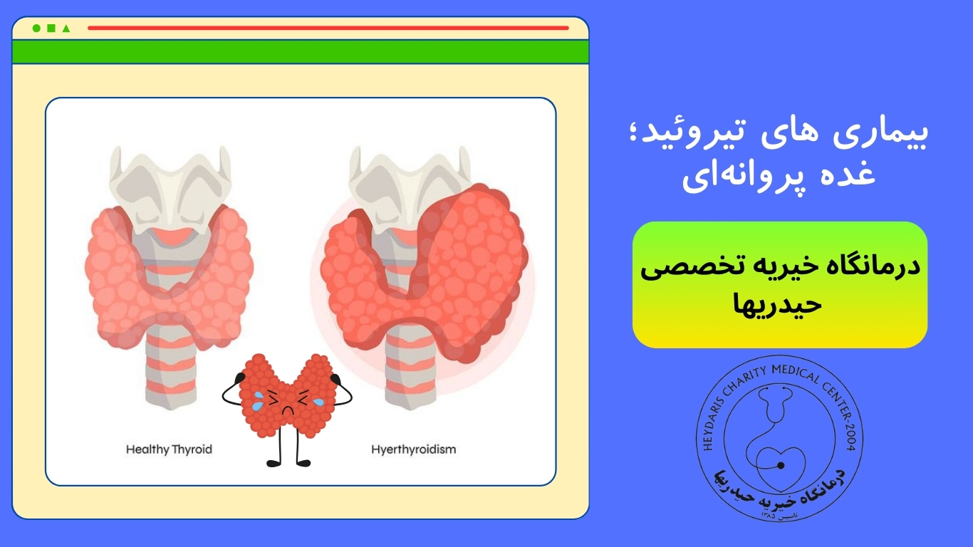 بیماری های تیروئید