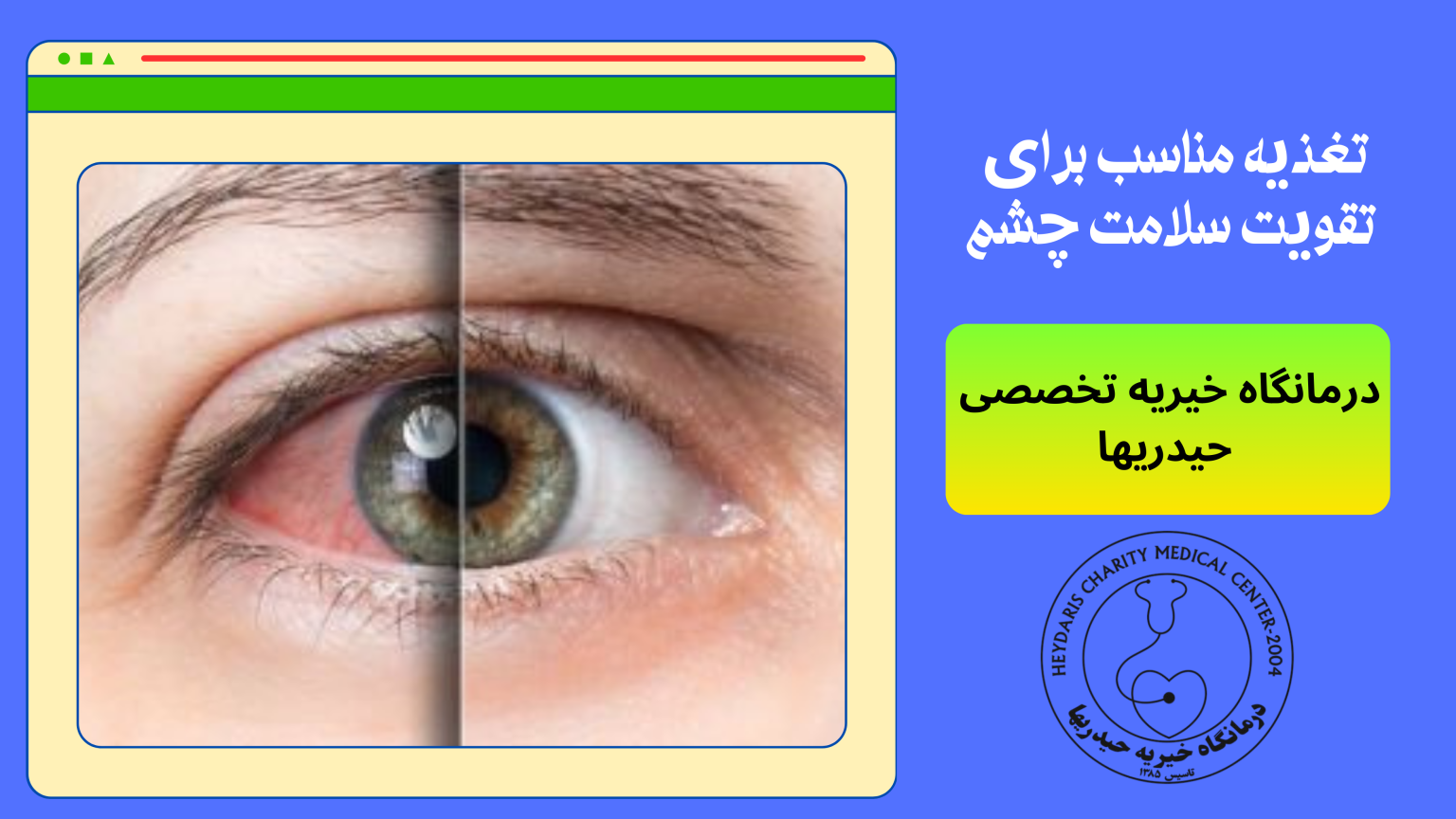 سلامت چشم
