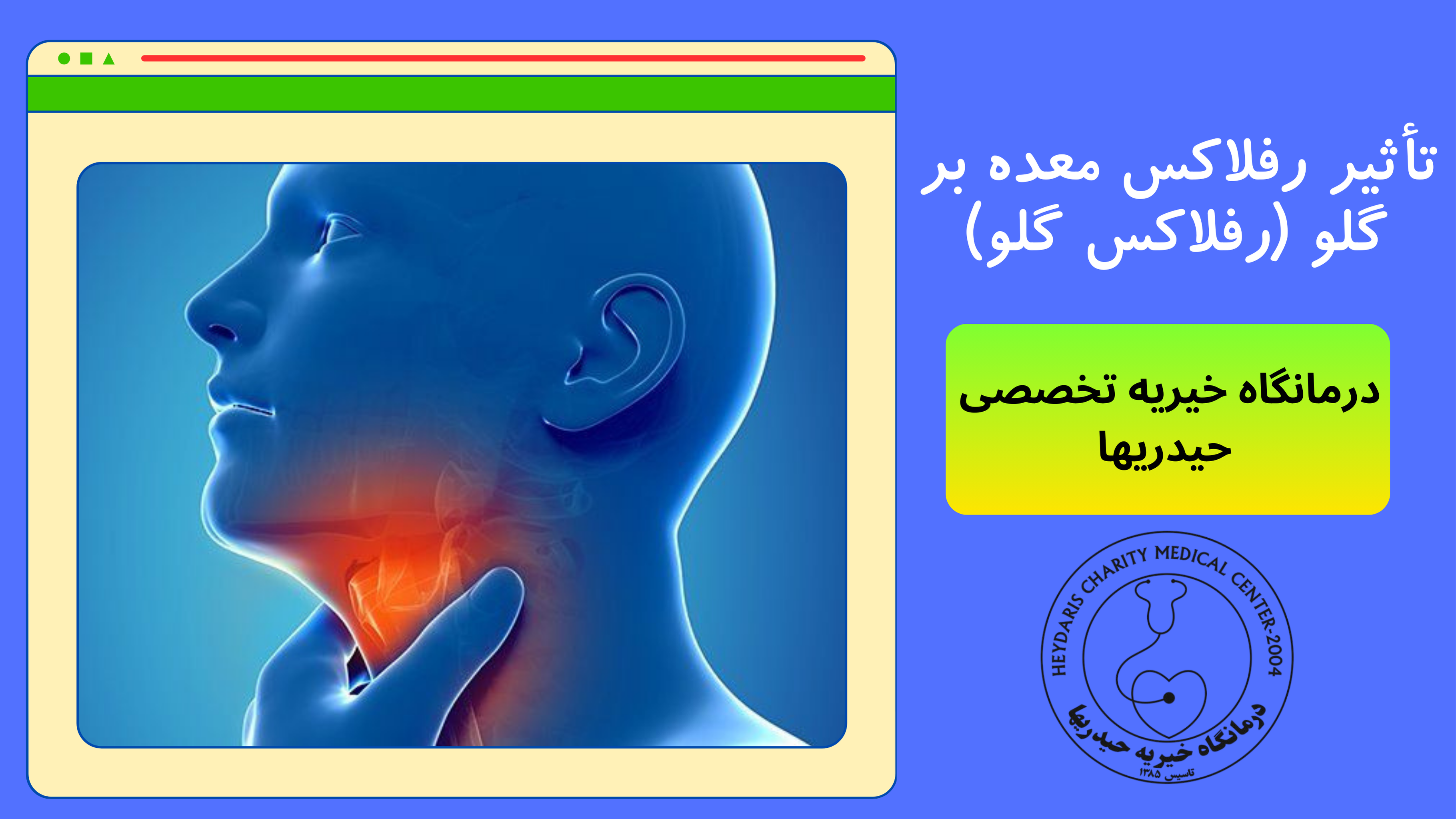 رفلاکس گلو