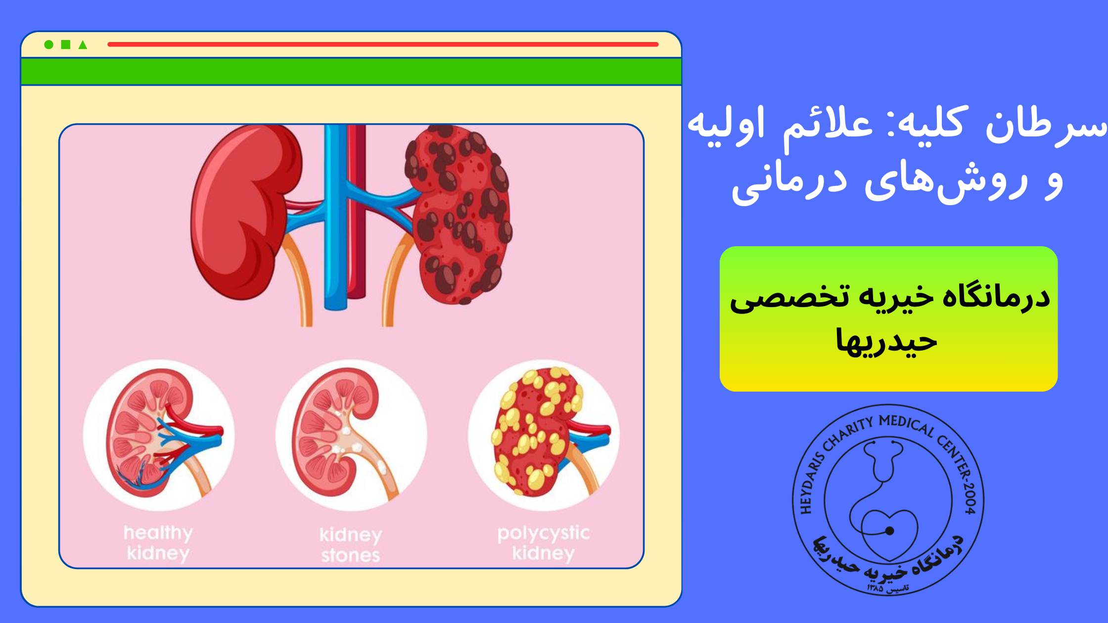 سرطان کلیه