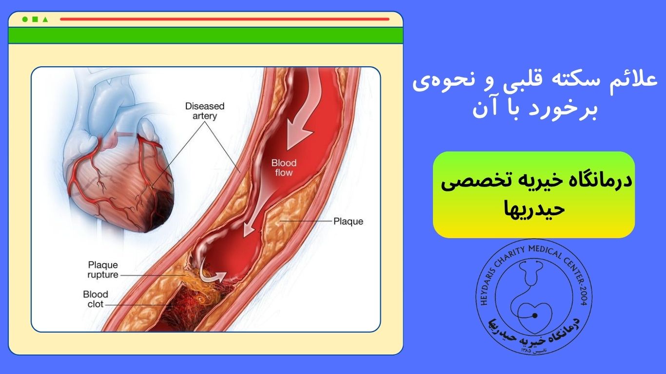سکته قلبی