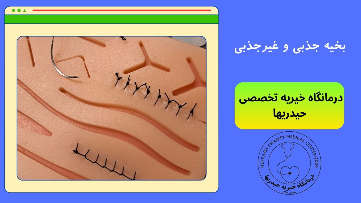 بخیه جذبی و غیرجذبی