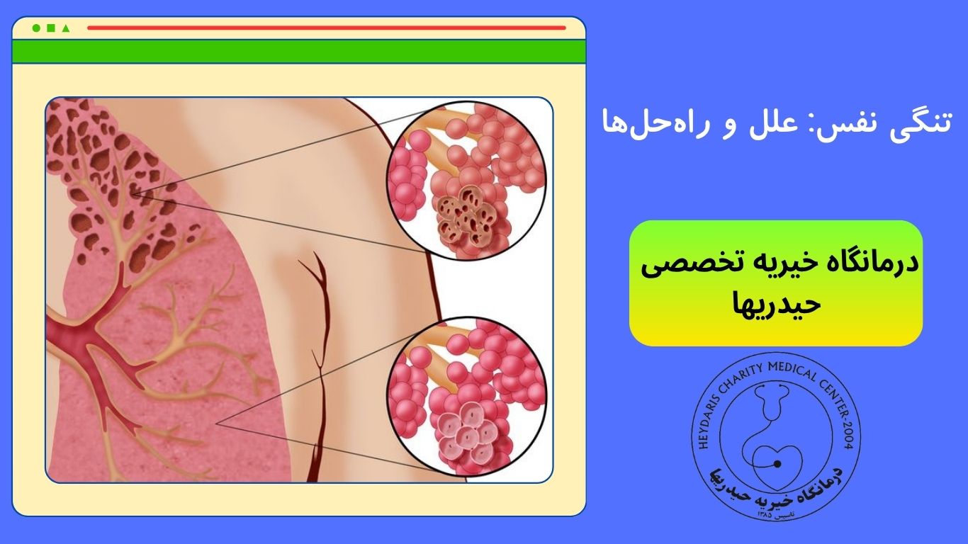 تنگی نفس