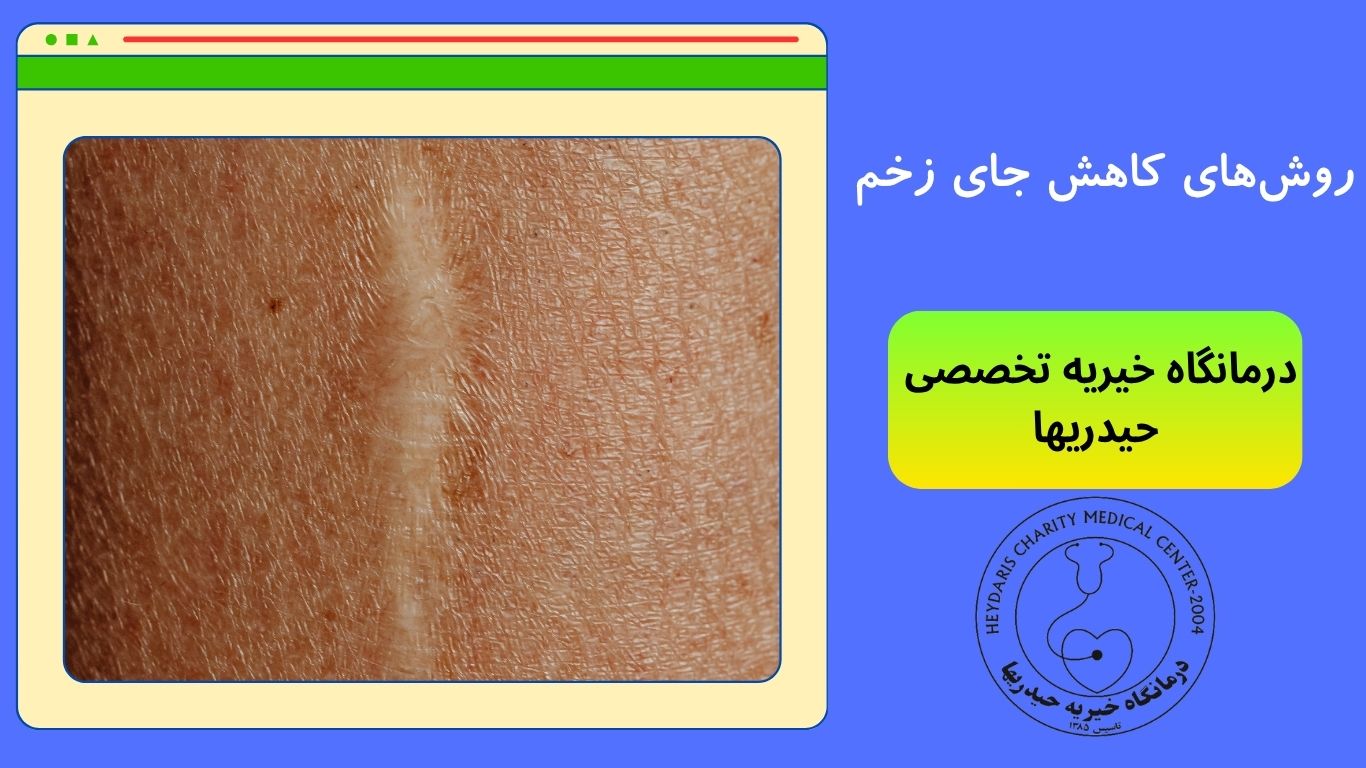 کاهش جای زخم