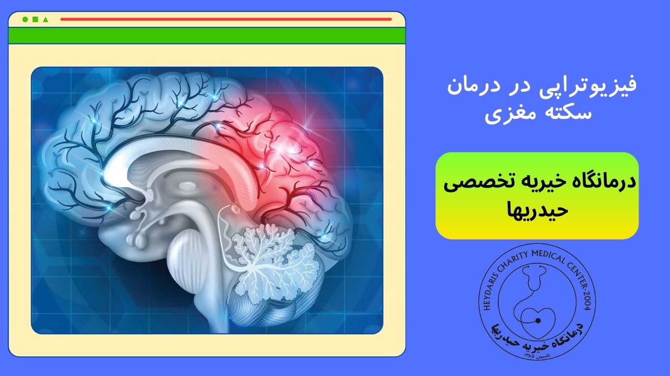 سکته مغزی