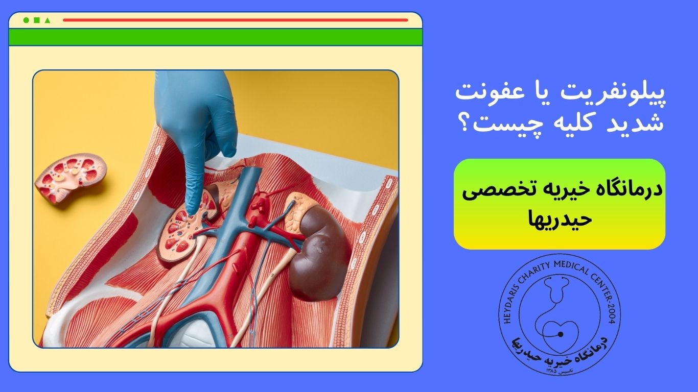 پیلونفریت