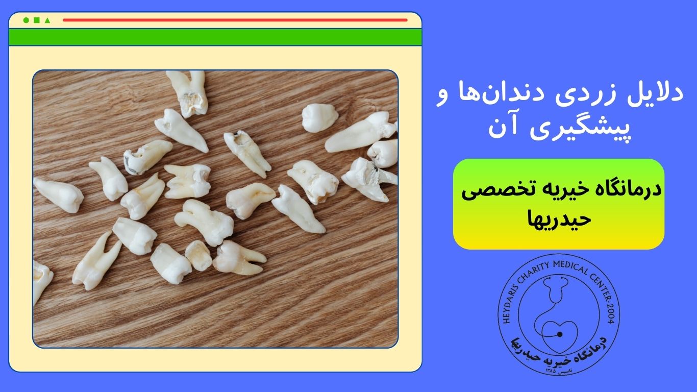 دلایل زردی دندان‌ها