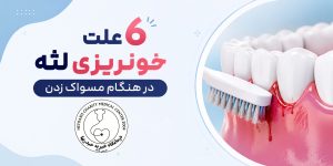 6 علت خونریزی لثه