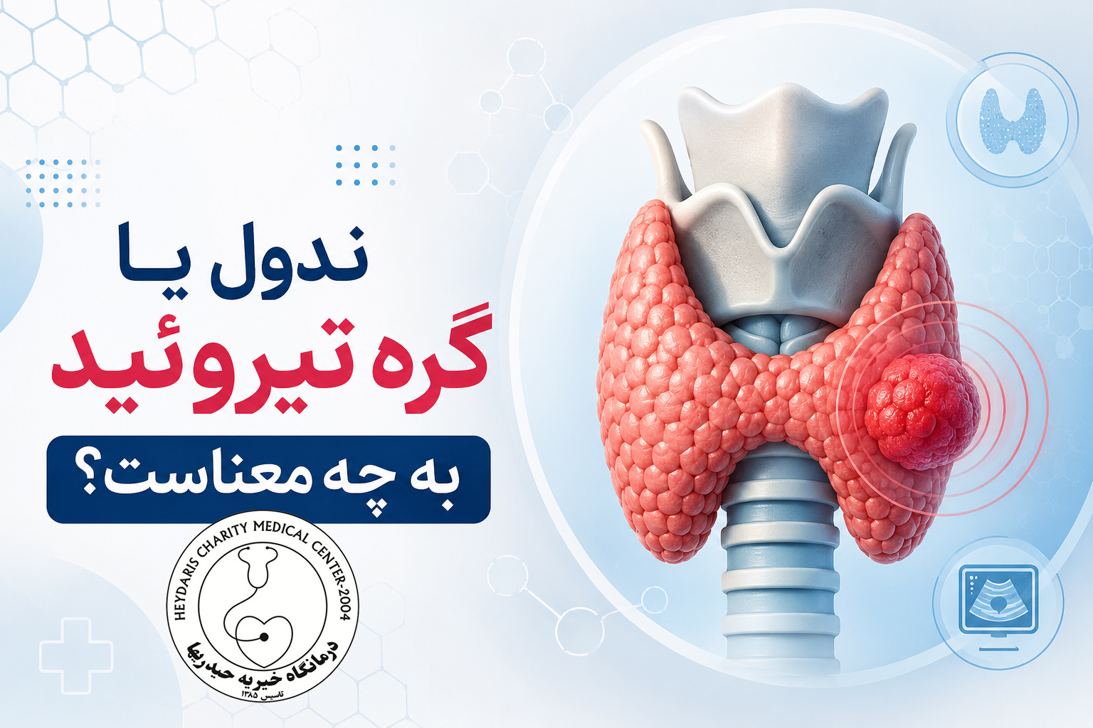 ندول یا گره تیروئید به چه معناست؟